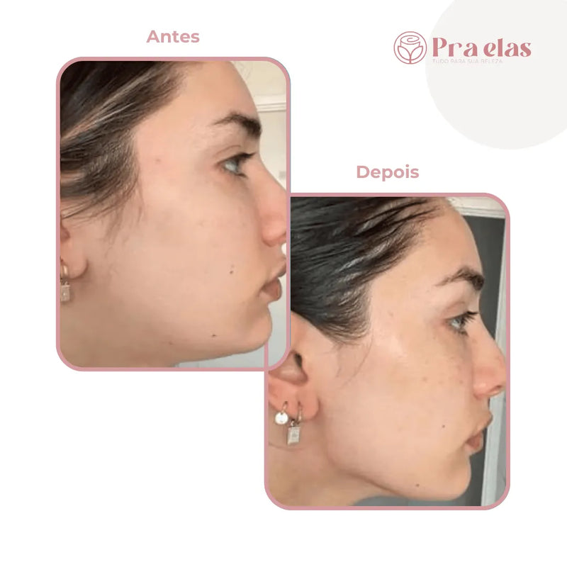 Mini Massageador Facial Elétrico - Pra Elas