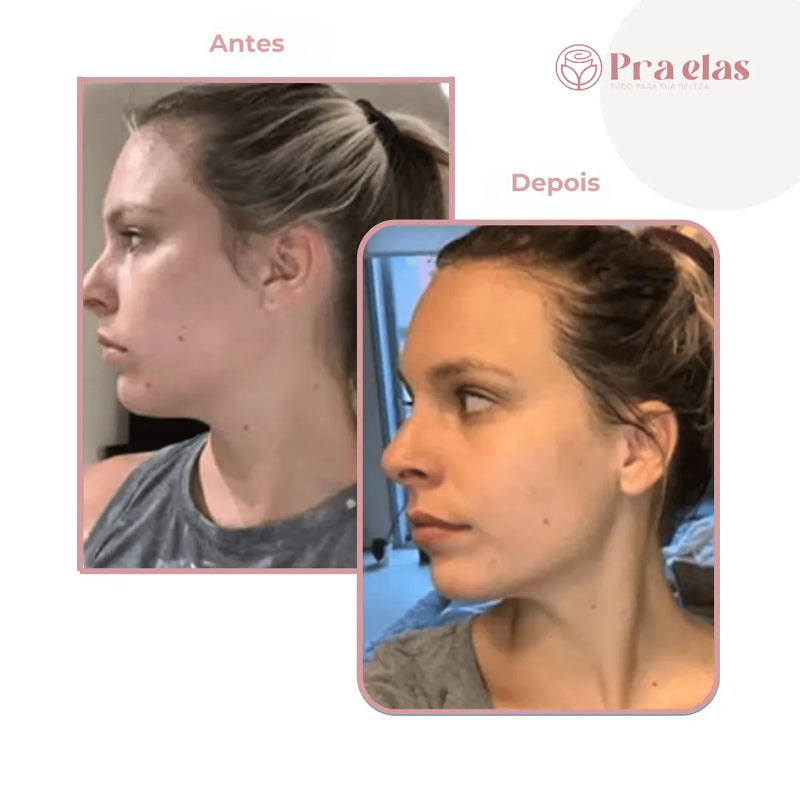 Mini Massageador Facial Elétrico - Pra Elas