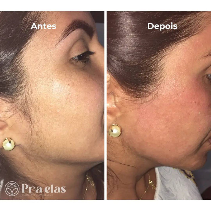 Caneta Depiladora Facial e Corporal - Pra Elas