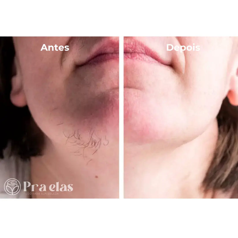 Caneta Depiladora Facial e Corporal - Pra Elas