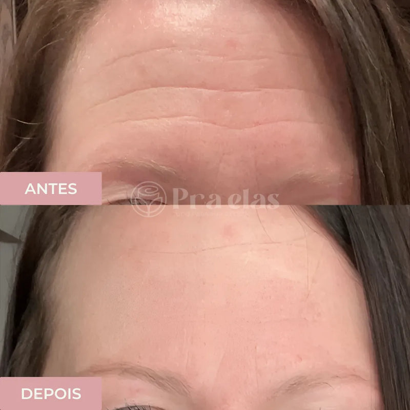 Creme Anti- Rugas Instantâneo - Pra Elas