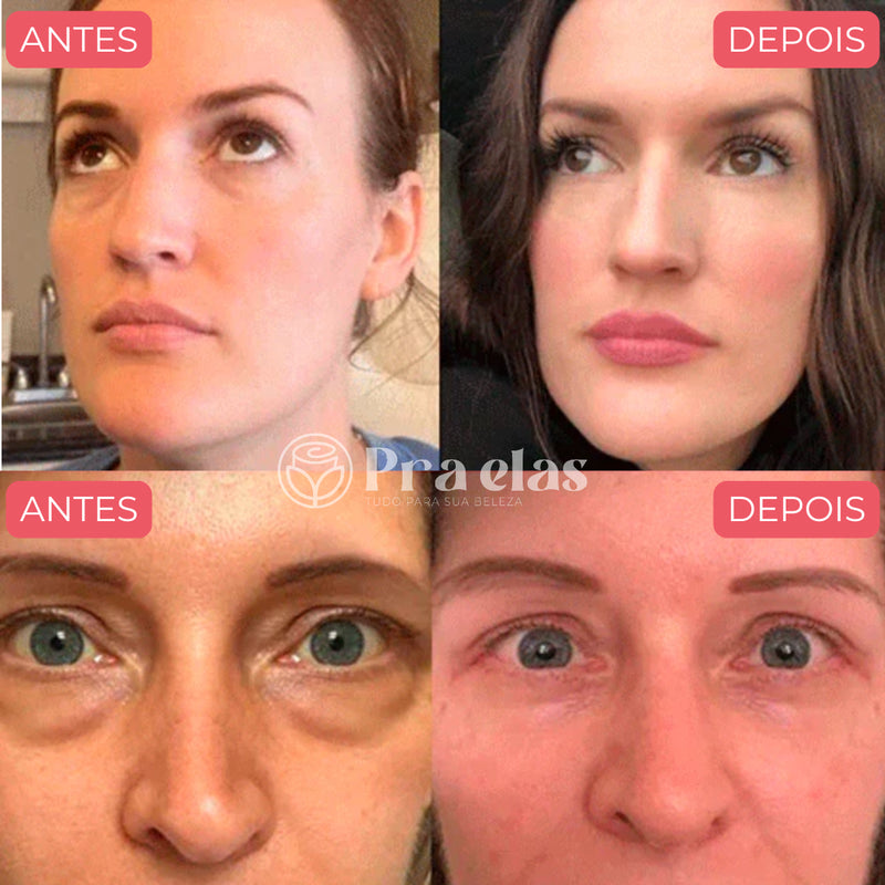 Sérum Retinol para Olhos em Batom