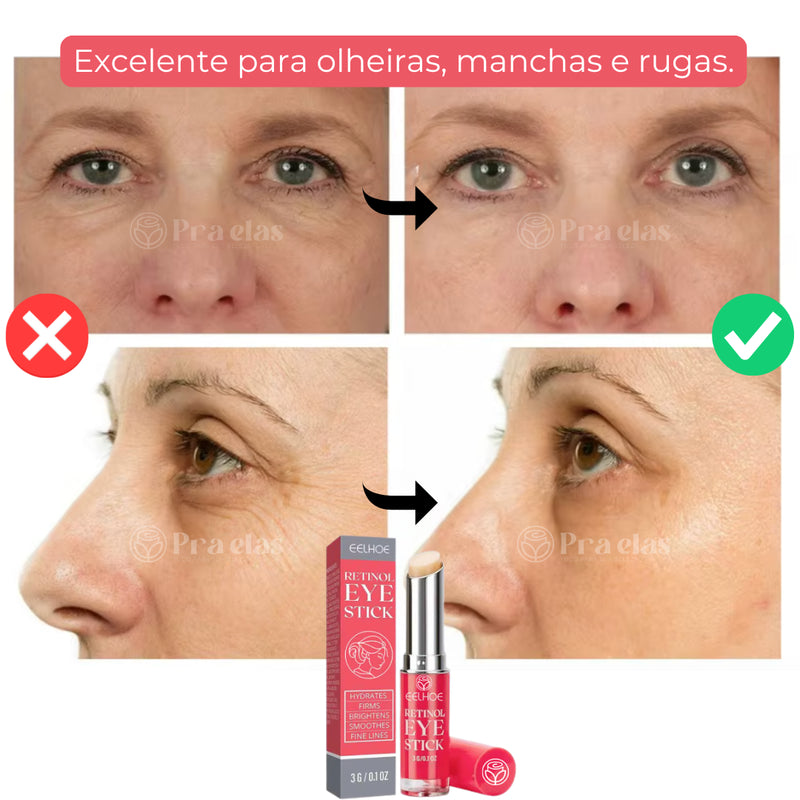 Sérum Retinol para região dos Olhos - em Batom